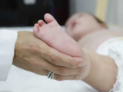 Atraso no teste do pezinho atrasa diagnóstico da AME no SUS